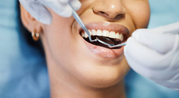 Best Emergency Dentist for Knocked-Out Tooth in South Jacksonvle, IL