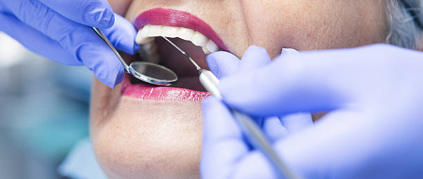 Best Emergency Dental Extractions in South Jacksonvle, IL